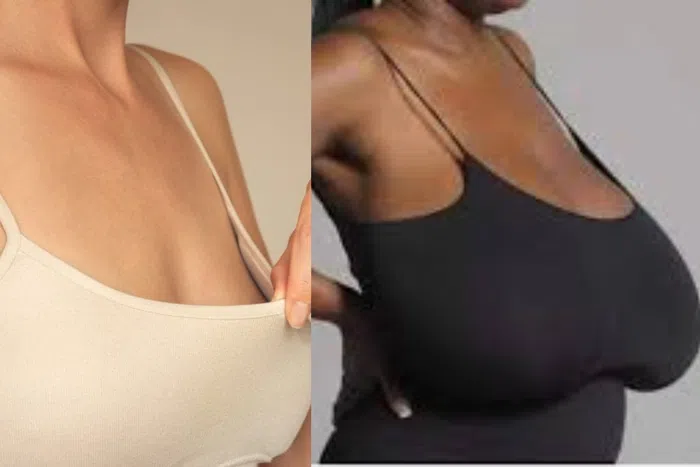 “7 Surprising Reasons Breast Sagging Can Happen Before Pregnancy”