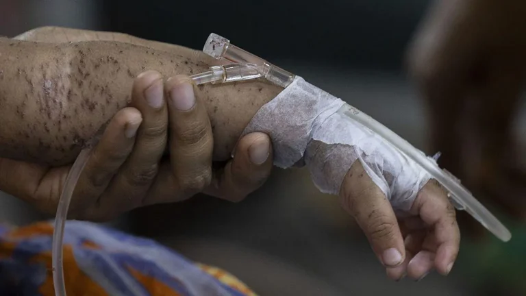 More than 500 children die as measles cases surge in Bangladesh