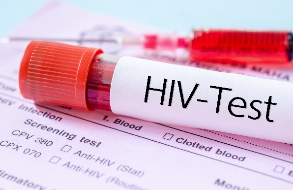 1,300 security recruits tested HIV positive – Interior Minister
