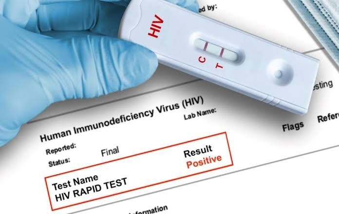 GHANET warns of HIV test kit shortage by end of July